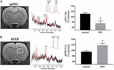 Single-Prolonged Stress Impairs Prefrontal Cortex Control of Amygdala and Striatum in Rats